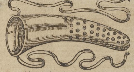 womb funigation in Thesaurus chirurgiae 2, 1610
